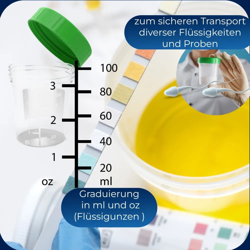 Horn Medical Urinproben-Becher 125ml mit Schraubverschluss|