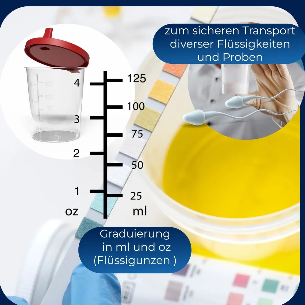 Horn Medical 10 Urinproben-Becher mit Schnappdeckel| Outlet