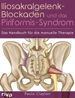 Iliosakralgelenk-Blockaden und das Piriformis-Syndrom> Sale