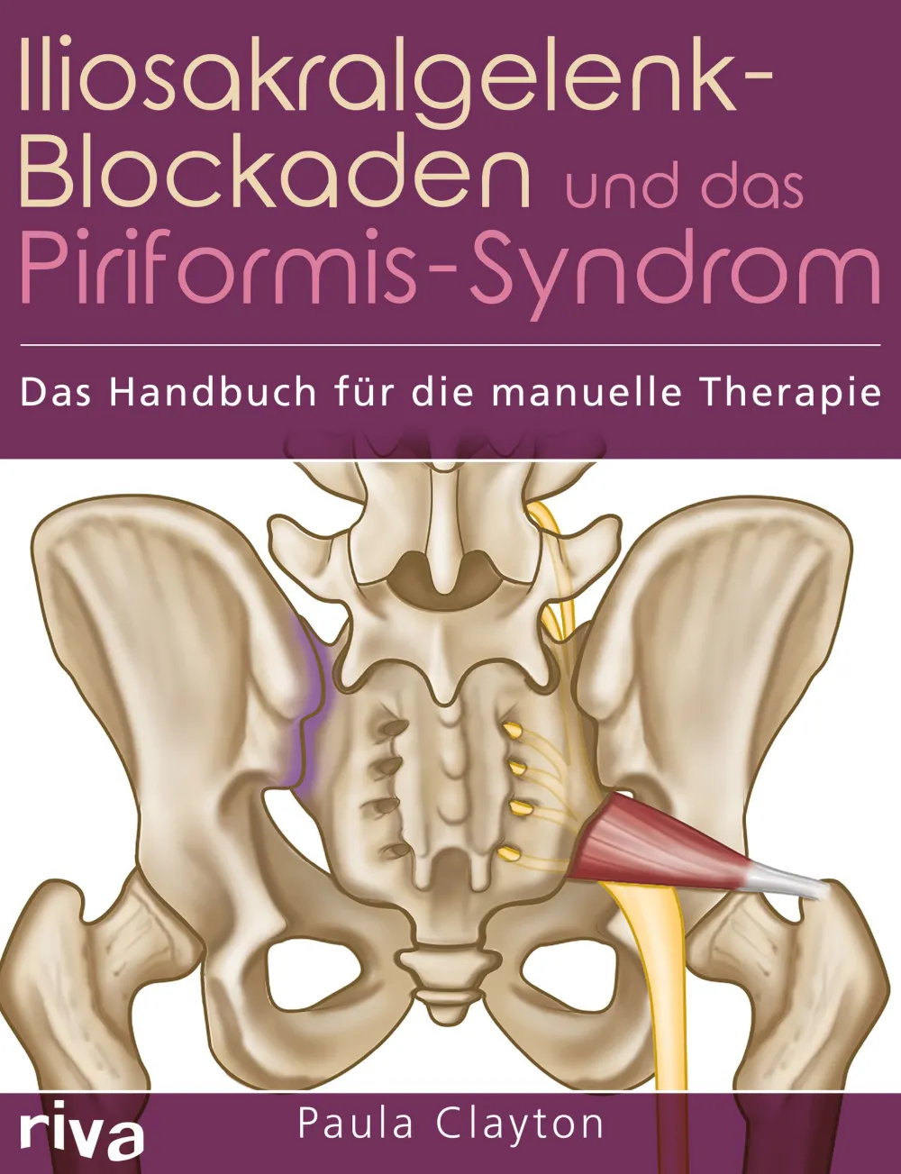 Iliosakralgelenk-Blockaden und das Piriformis-Syndrom> Sale