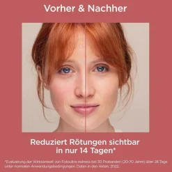 Fotoultra Redness Sonnencreme bei sehr empfindlicher Haut, Rosacea und Couperose|ISDIN Online