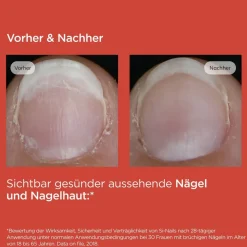 ® Si-Nails Nagelhärter><noscript><img width=