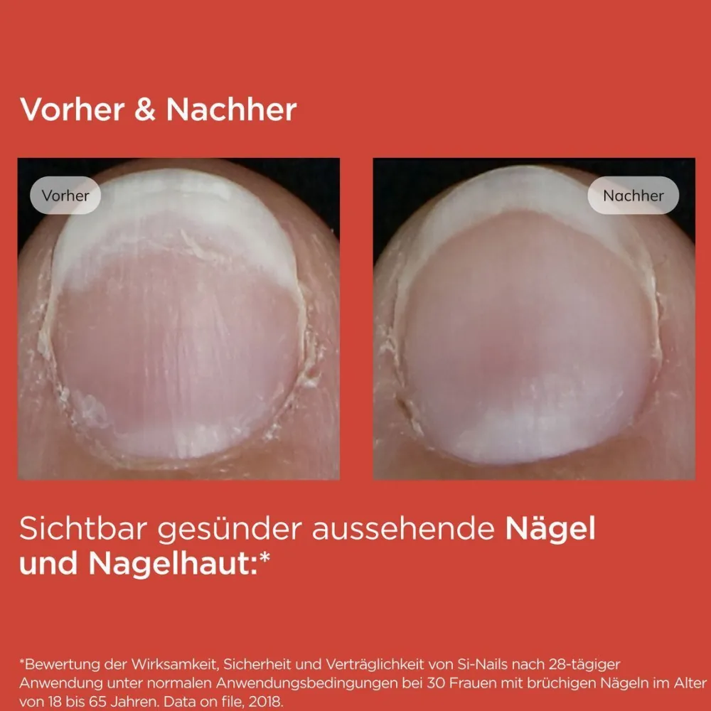 ® Si-Nails Nagelhärter>ISDIN Sale