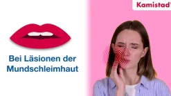 Kamistad® Gel bei Zahnfleischentzündungen und Aphten> Hot