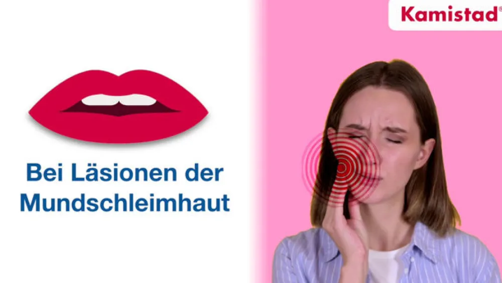 Kamistad® Gel bei Zahnfleischentzündungen und Aphten> Hot