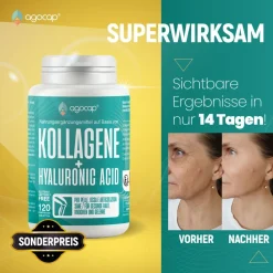 Kollagen Hyaluron Komplex mit Coenzym Q10 – Beauty Formel für Haut, Haare & Nägel – 120 Tabletten| Discount