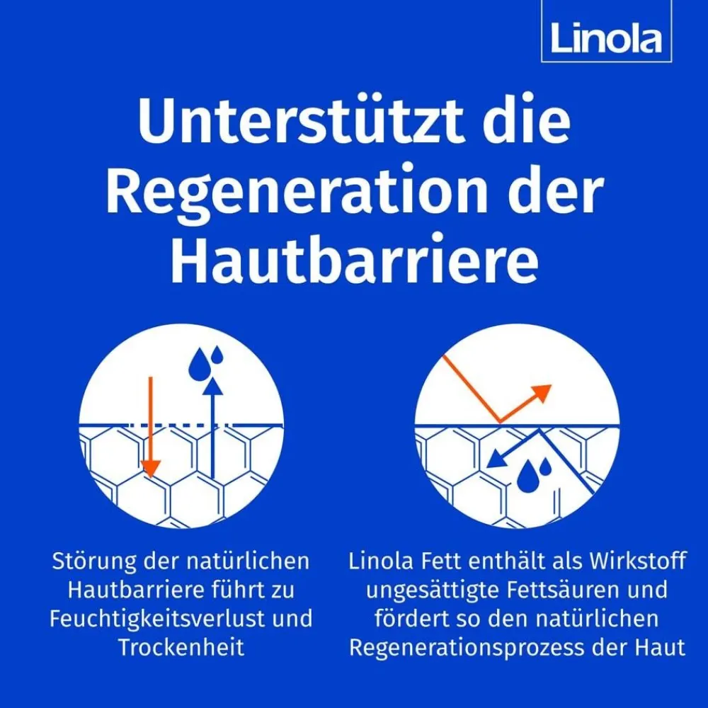 Linola Fett Creme – Für trockene, gereizte Haut bei Neurodermitis> Online