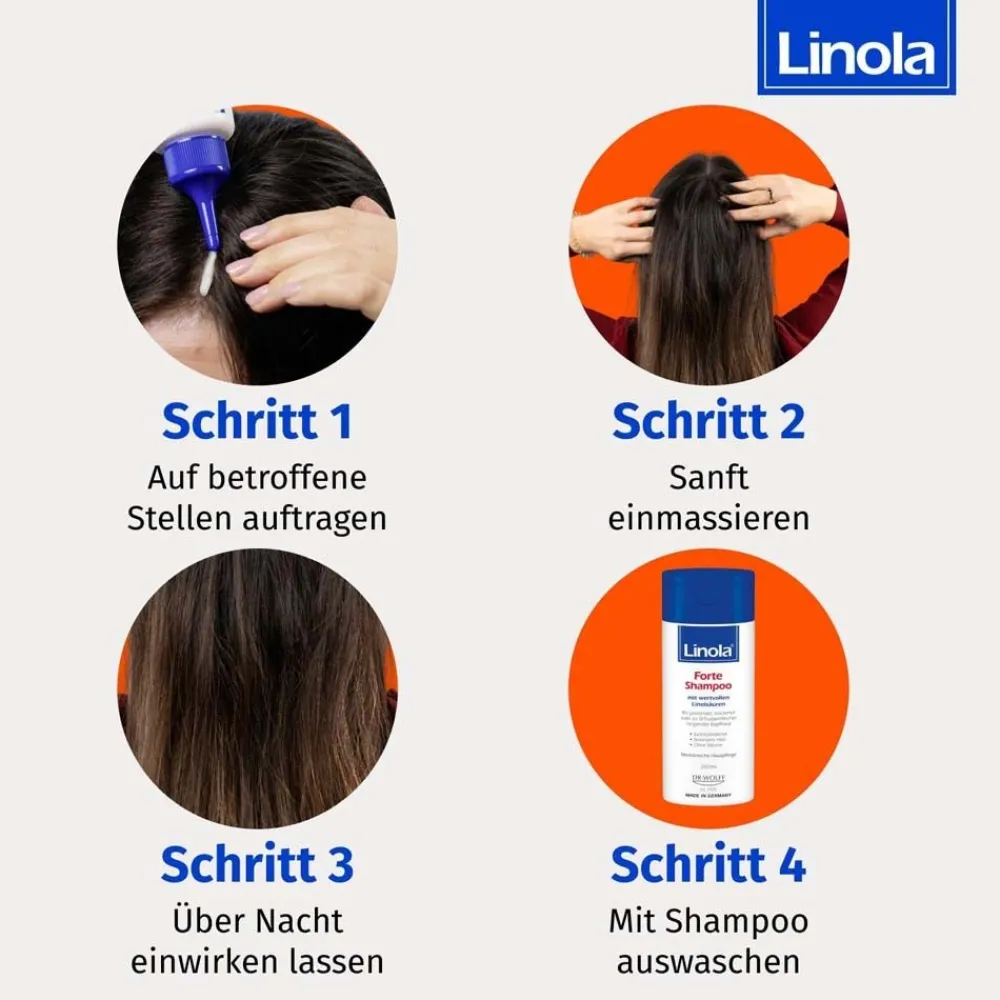 Forte Kopfhaut-Tonikum - Haartonikum für juckende, trockene oder schuppige Kopfhaut>Linola Sale