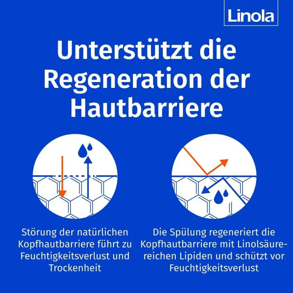 Haar- und Kopfhautspülung - Pflege-Spülung für trockene und empfindliche Kopfhaut|Linola