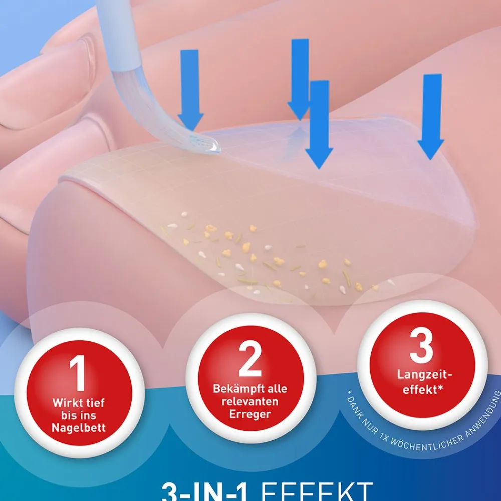 LOCERYL® Nagellack gegen Nagelpilz mit DIREKT-Applikator + LOCERYL® Creme> Best