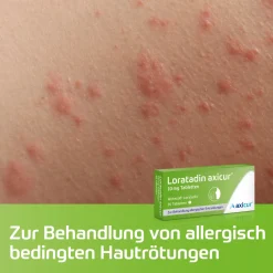 Loratadin axicur®| Best