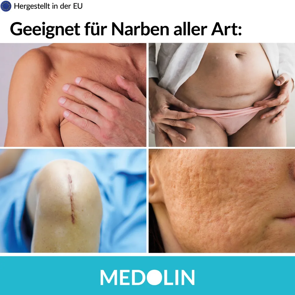 Medolin® Narbengel - Narbensalbe für schöne Haut - Effektive Narbencreme|