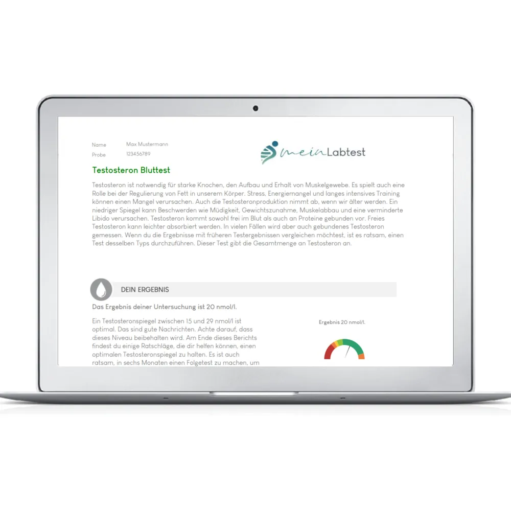 Meinlabtest Testosteron Test| Clearance