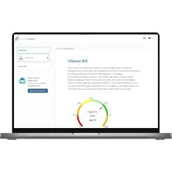 Meinlabtest Vitamin B12 (Bluttest)| Outlet