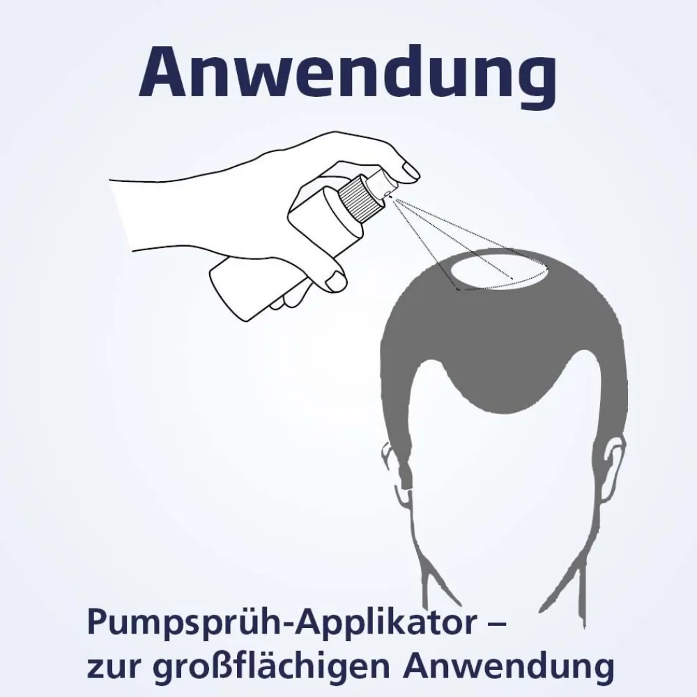 Minoxicutan® Männer 50 mg/ml| Clearance
