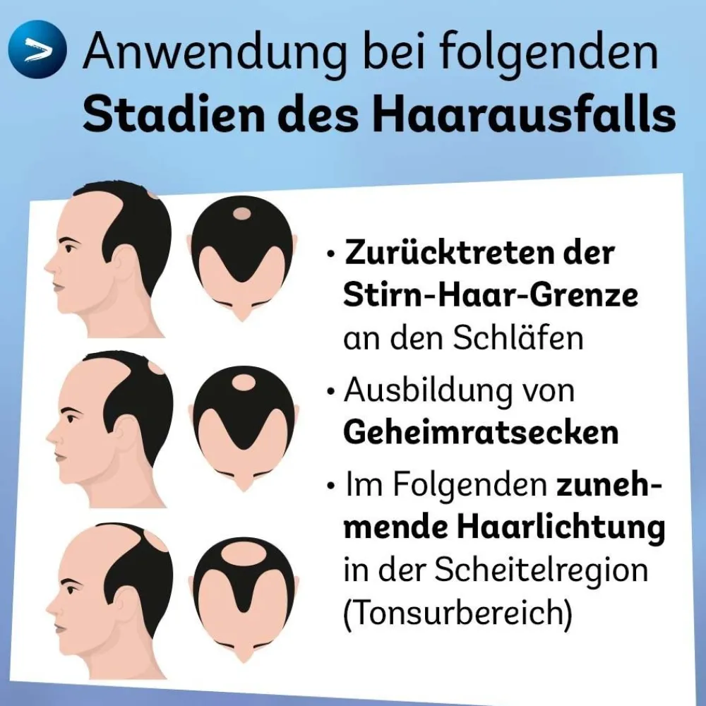 Minoxidil Dexcel® 50 mg/ml Spray, bei erblich bedingtem Haarausfall bei Männern| Online