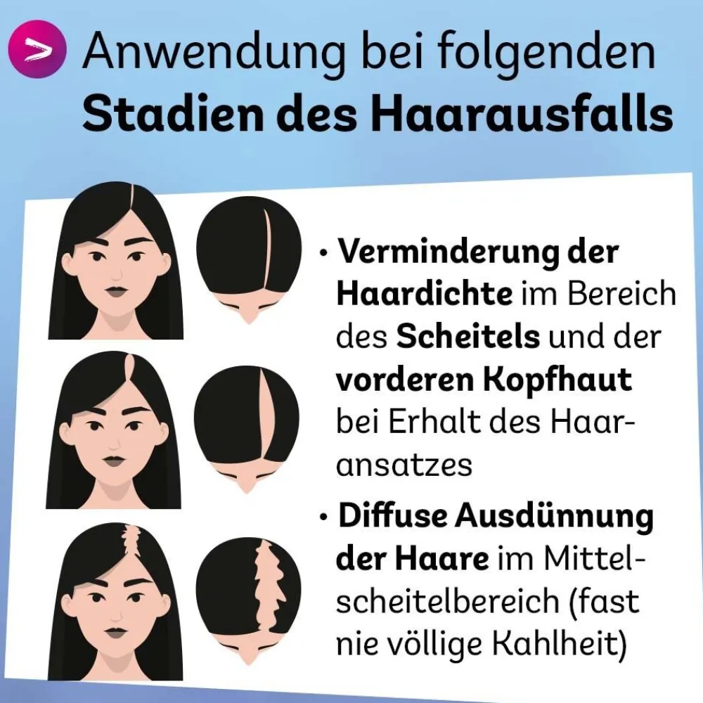 Minoxidil Dexcel® 20 mg/ml Spray, bei erblich bedingtem Haarausfall bei Frauen| Clearance