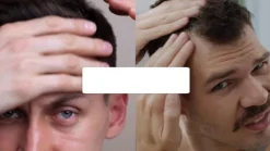 Minoxidil Pharma Männer 50 mg/g Schaum zur Anwendung auf der Haut (Kopfhaut)|Doppelherz