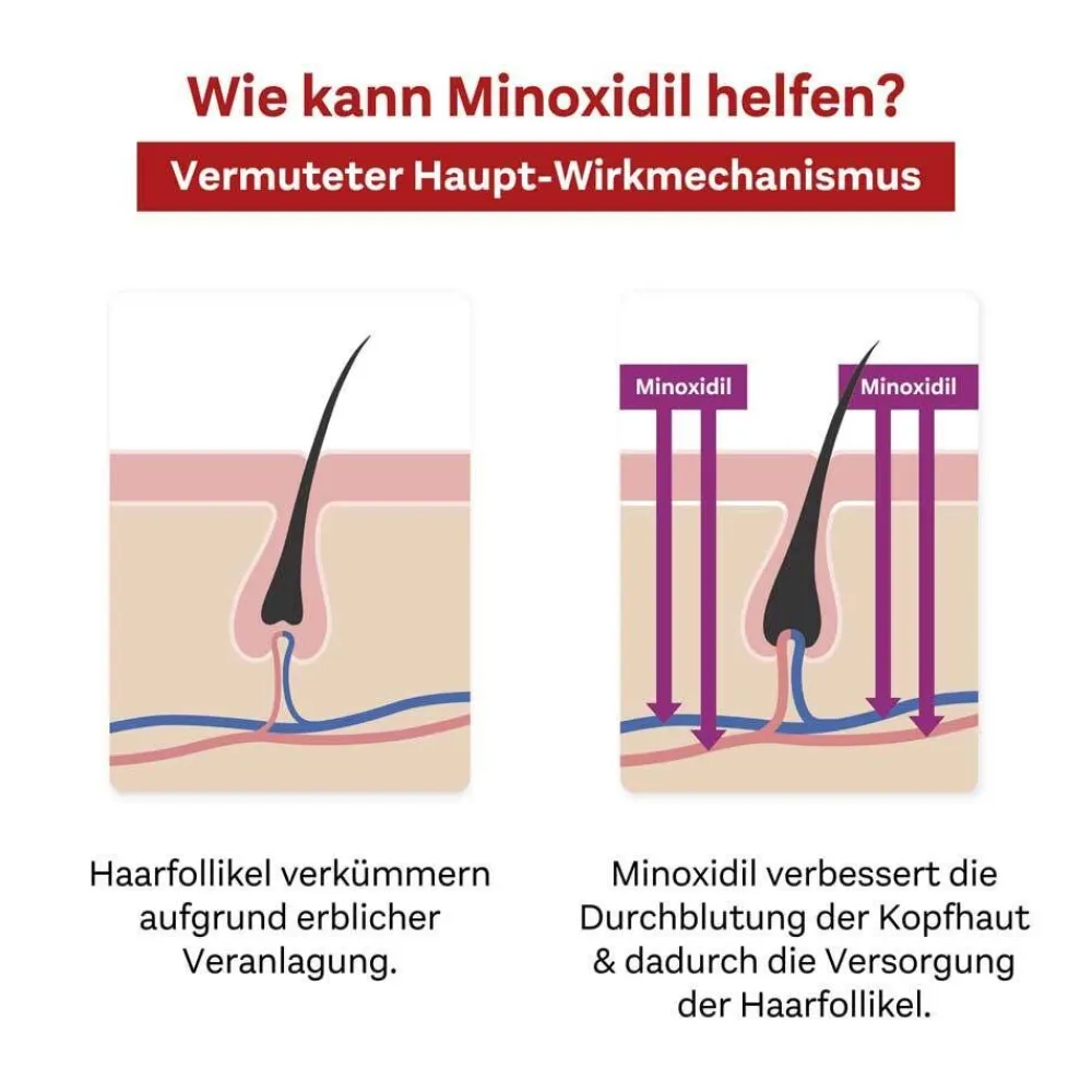 MINOXIDIL Pharma 20 mg/ml>Doppelherz Discount