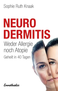 Neurodermitis| Hot