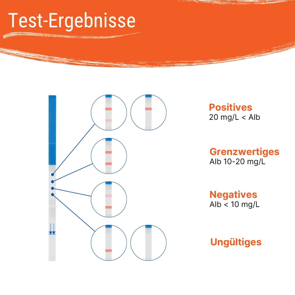 Nierenfunktionstest - Albumin Urin Selbsttest für Zuhause, Niere prüfen - Patris Health®| Outlet