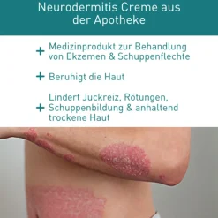 Psoriasis & Neurodermitis Intensivcreme gegen trockene, gereizte & schuppige Haut><noscript><img width=