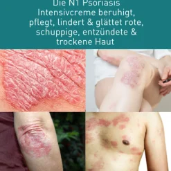 Psoriasis & Neurodermitis Intensivcreme gegen trockene, gereizte & schuppige Haut><noscript><img width=