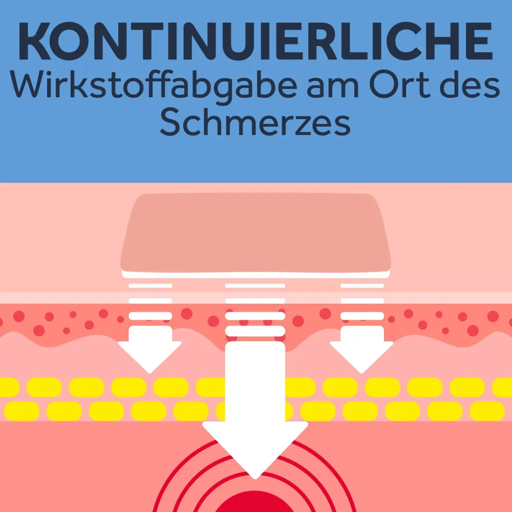 24-Stunden Ibuprofen Schmerzpflaster 200 mg|Nurofen Online