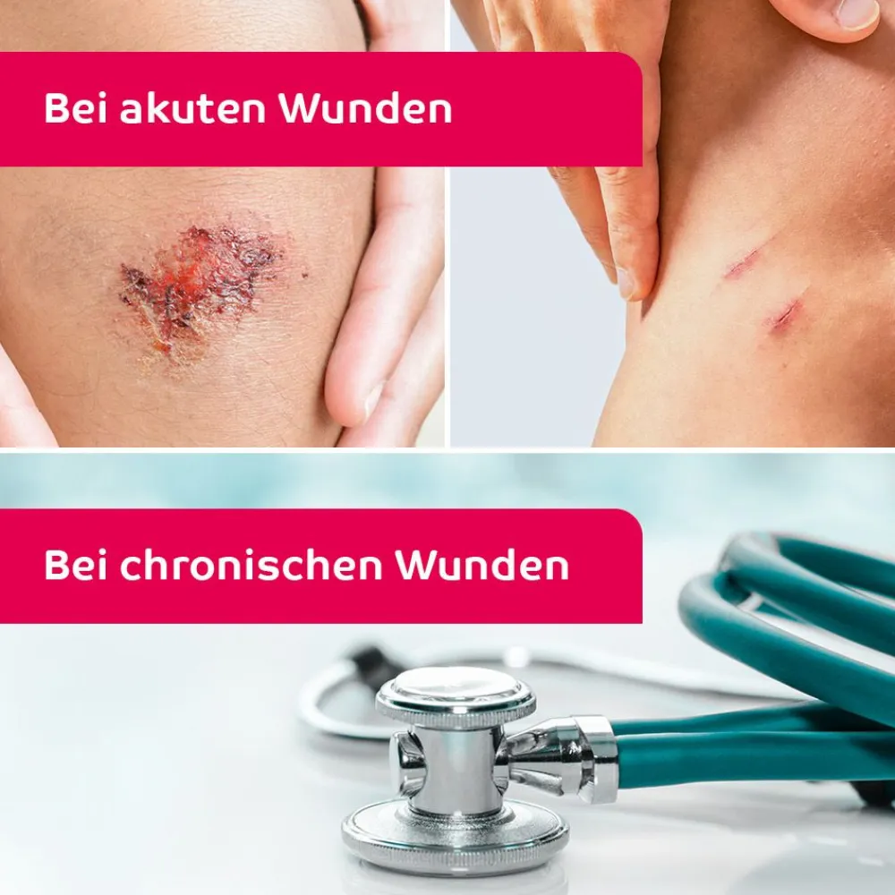 ® Wund-Desinfektion-Spray>octenisept