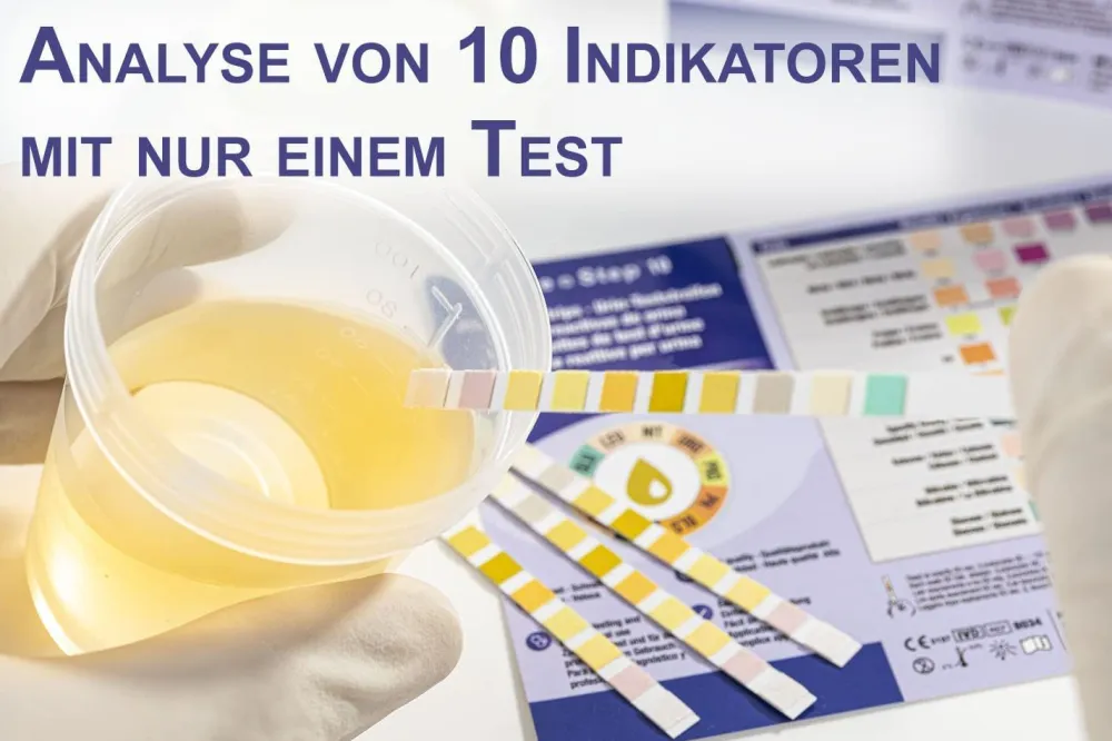 One+Step Urinteststreifen für 10 Indikatoren - Gesundheitstest inkl. Referenzfarbkarte>one-step Clearance