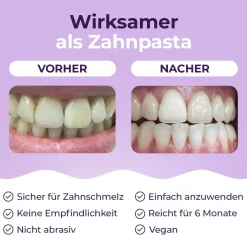 OnlySmile® Zahnaufhellungspulver für Weiße Zähne><noscript><img width=