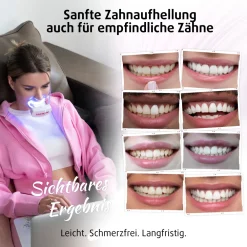 PearlSmile Zahnaufhellungsset| Discount