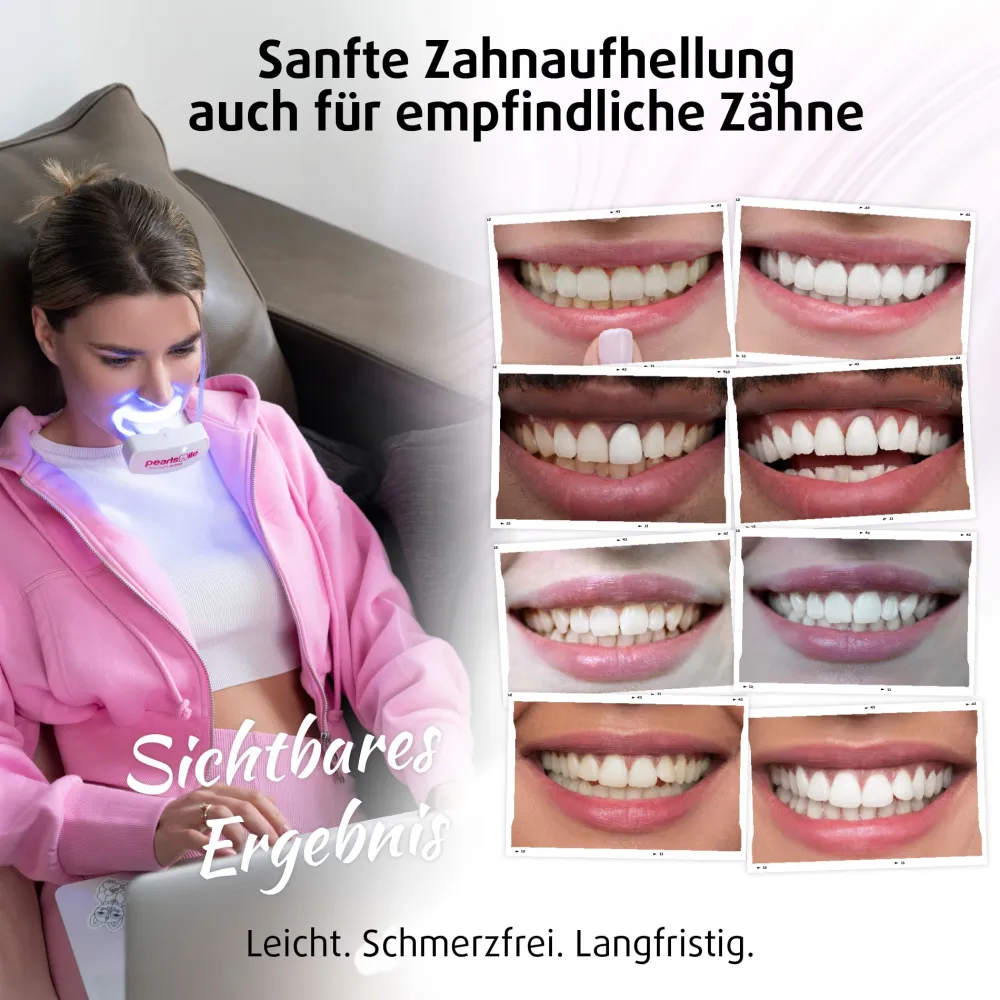 PearlSmile Zahnaufhellungsset| Discount