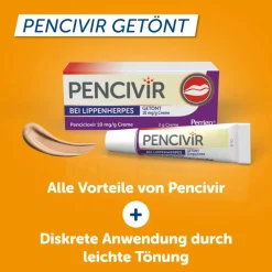 Pencivir bei Lippenherpes Penciclovir 10mg/g Creme| Best
