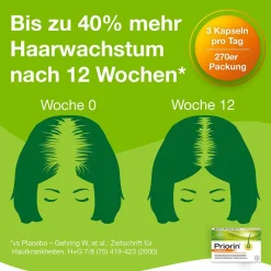 ® Haarpflege-Set: bei hormonell erblich bedingtem Haarausfall bei Frauen|Priorin Discount
