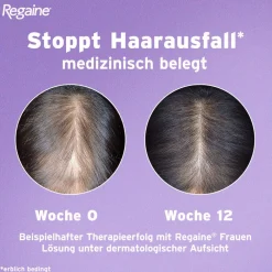 Frauen Schaum mit Minoxidil bei erblich bedingtem Haarausfall - Jetzt 20% mit dem Code 20 sparen*|Regaine Clearance