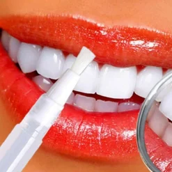Rident Zahnaufhellungsstift - Zahnverfärbungen reduzieren - Zahnbleaching-Stift| Discount