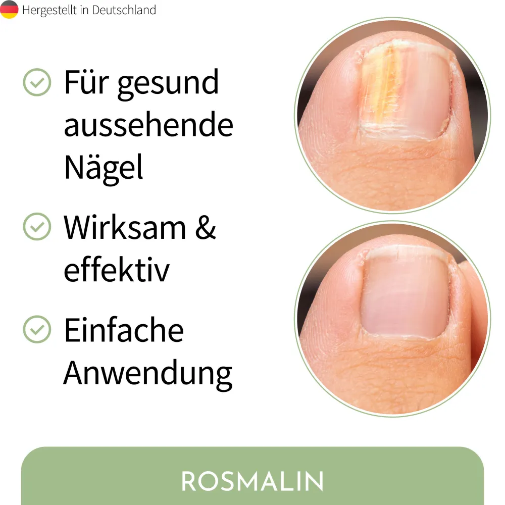 Rosmalin® Nail Care Pen - Nagelpilz Pflege>