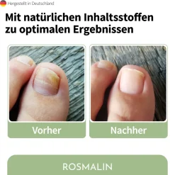 Rosmalin® Nail Care Pen - Nagelpilz Pflege><noscript><img width=