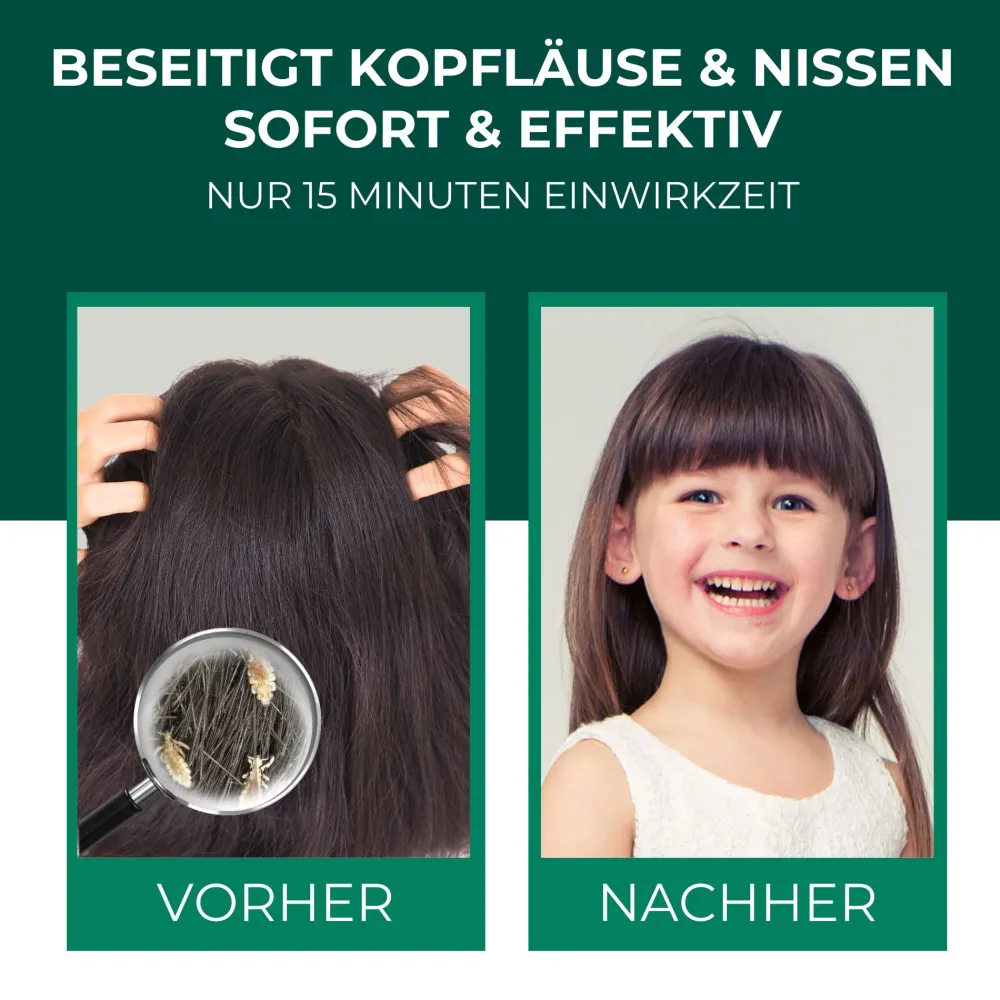Läuseshampoo>SILBERKRAFT Outlet
