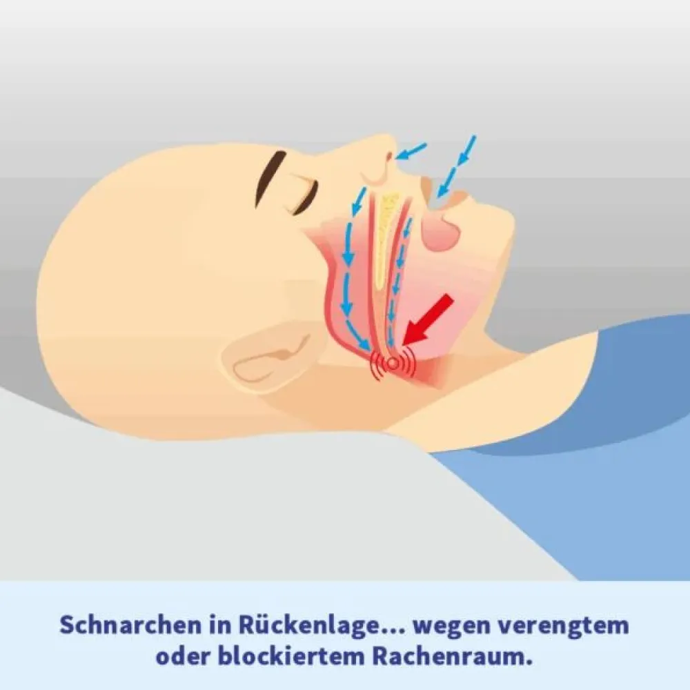Somnipax Belt 2.0 - Anti Schnarchgurt| Hot