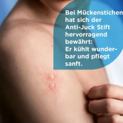 Anti-Juck Stift bei Insektenstichen|Soventol Clearance