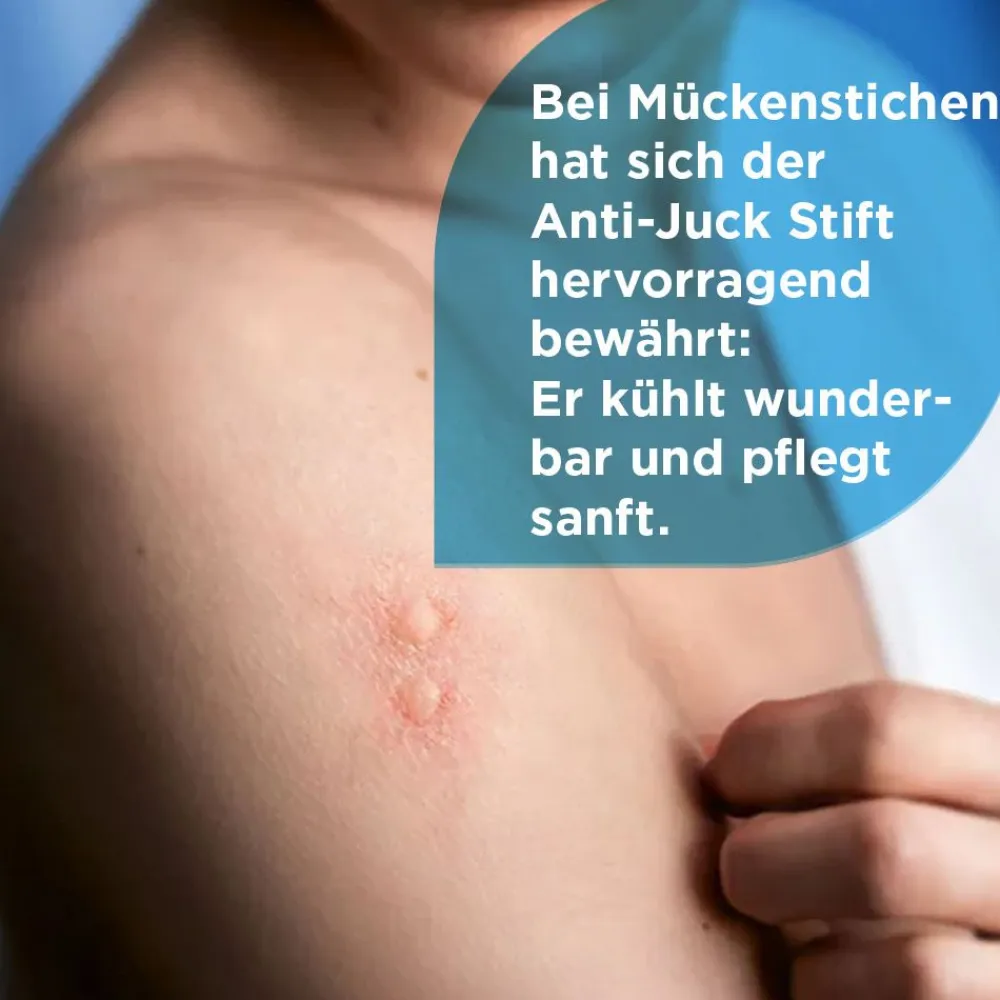 Anti-Juck Stift bei Insektenstichen|Soventol Clearance