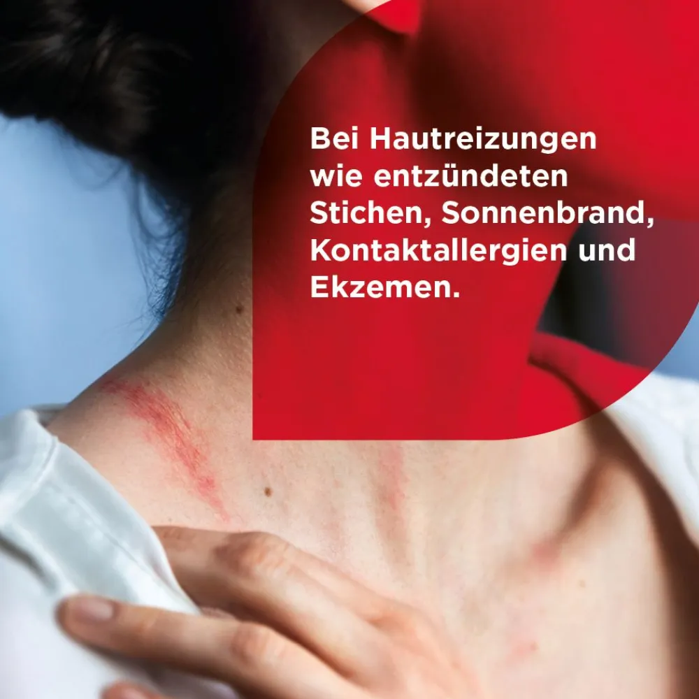 HydroCortisonACETAT 0,5% Hautentzündungen>Soventol Clearance