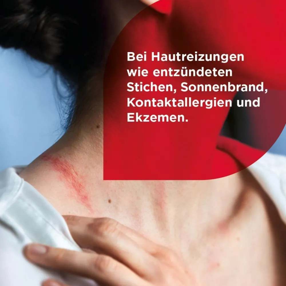 HydroCortisonACETAT 0,25% Hautentzündungen|Soventol Online