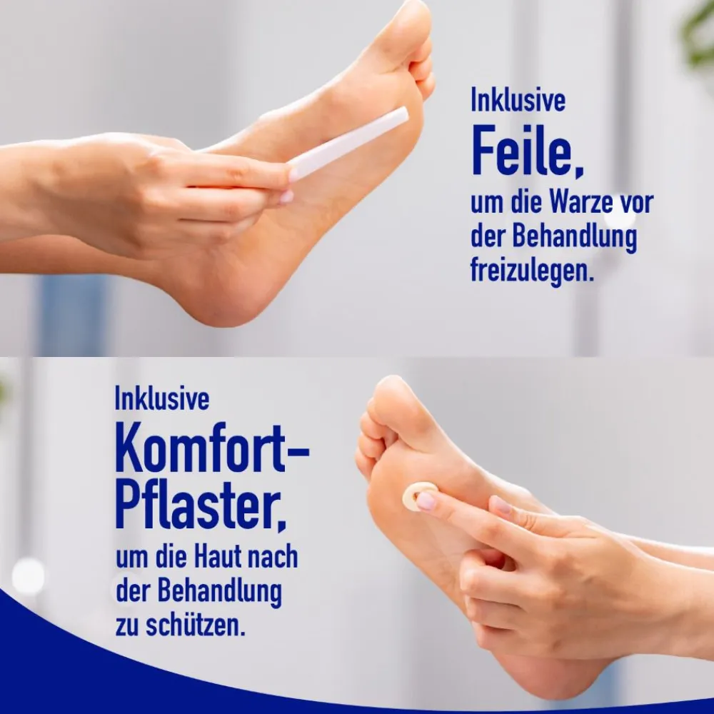 ® gegen Fußwarzen>WARTNER