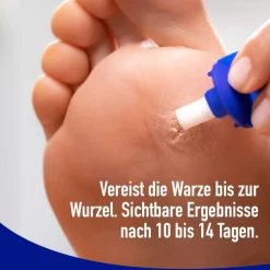 ® gegen Fußwarzen><noscript><img width=