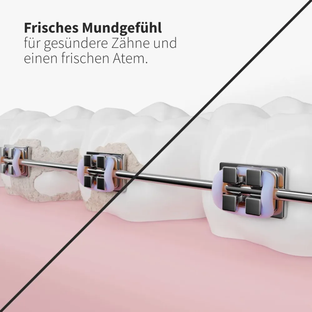 Ersatzdüsen Deep Care schwarz (6 Stück) - effektive Reinigung der Zahnzwischenräume|zahnheld Sale