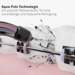 Ersatzdüsen Sensitiv schwarz (9 Stück) - für sensibles Zahnfleisch & Zähne|zahnheld Best
