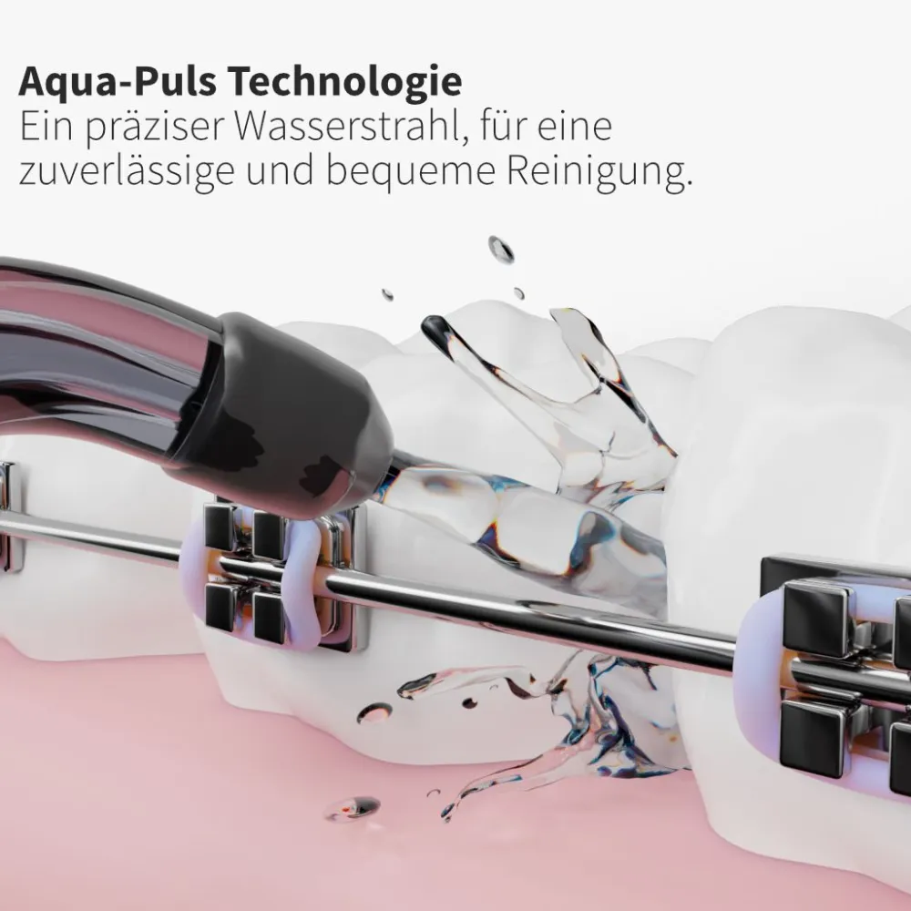 Ersatzdüsen Sensitiv schwarz (9 Stück) - für sensibles Zahnfleisch & Zähne|zahnheld Best